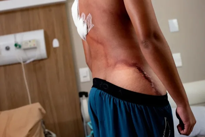 jovem-ferido-por-raio-durante-ato-politico-deixa-hospital