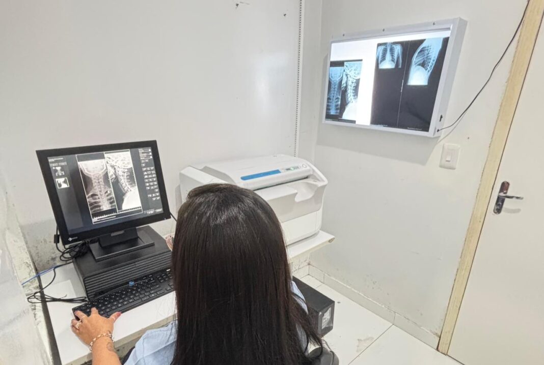 porto-walter-e-marechal-thaumaturgo-recebem-modernizacao-no-servico-de-raio-x-para-agilizar-diagnosticos-no-interior