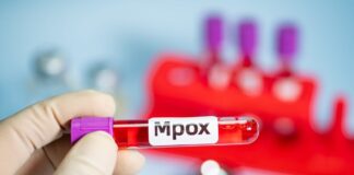 Mpox chega a 81 casos no Brasil em 2026 mpox-chega-a-81-casos-no-brasil-em-2026