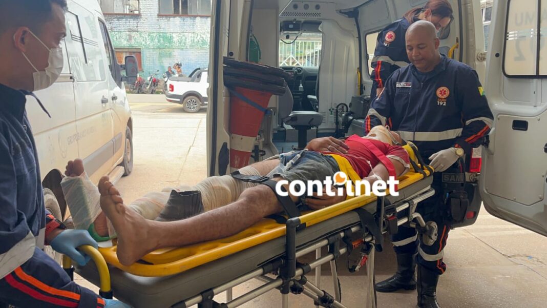 jovem-tem-fratura-exposta-apos-atingir-cacamba-em-avenida-movimentada-de-rio-branco