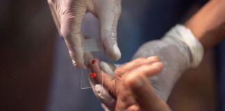 SUS começa a usar novo tratamento contra a malária em crianças sus-comeca-a-usar-novo-tratamento-contra-a-malaria-em-criancas