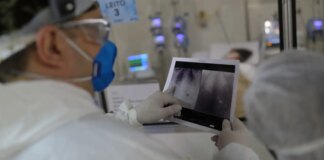 broncopneumonia:-entenda-quadro-que-causou-internacao-de-bolsonaro