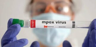 suspeita-de-mpox-e-descartada-apos-exames;-paciente-segue-internada-em-rio-branco