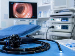 colonoscopia preventiva exame intestino câncer Rio Branco