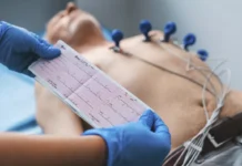 Eletrocardiograma