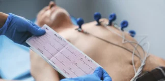 Eletrocardiograma
